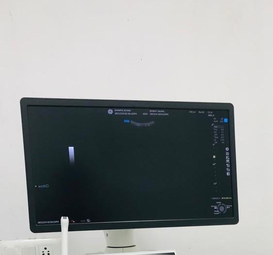 X-Ray